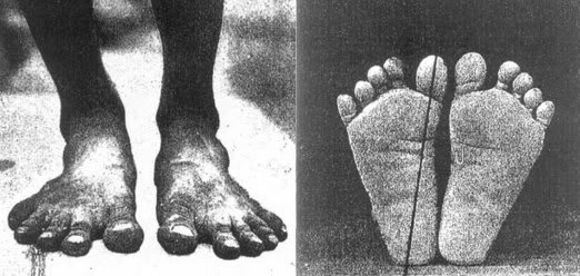 barefoot shoes for flat feet